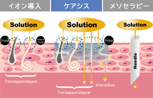 イオン導入　ケアシス　メソセラピー　比較